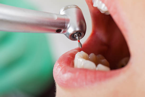 Best Pediatric Emergency Dentist in Ayden, NC